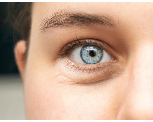 Айлис (Eyeliss) аналог EYE'FECTIVE, 5 г